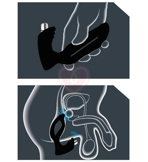 Стимулятор простаты с вибрацией JoyDivision Xpander X4+ размер S фото 3