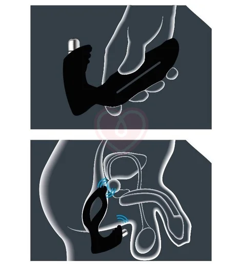 Стимулятор простаты с вибрацией JoyDivision Xpander X4+ размер L фото 2